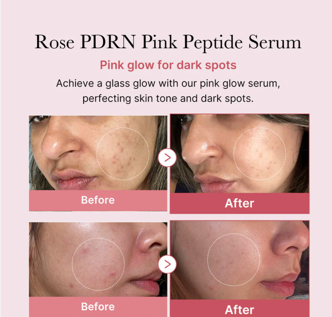 Medicube PDRN Pink Peptide Serum 30ml